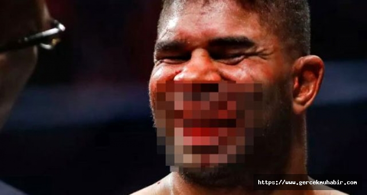 Maç sırasında Alistair Overeem'in dudağı koptu!