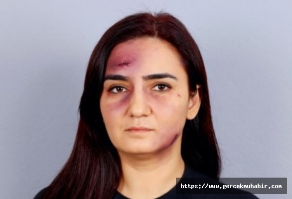 Sevda Erdan Kılıç: “Kadına şiddeti aklama, suça ortak olma”
