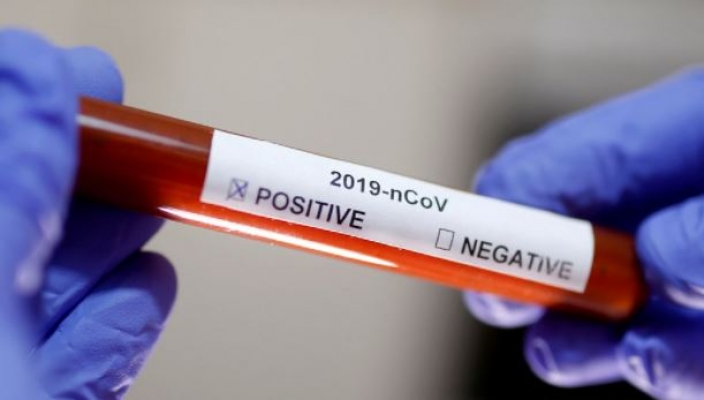 Koronavirüs nedeniyle 11 kişi hayatını kaybetti, bin 772 yeni vaka tespit edildi