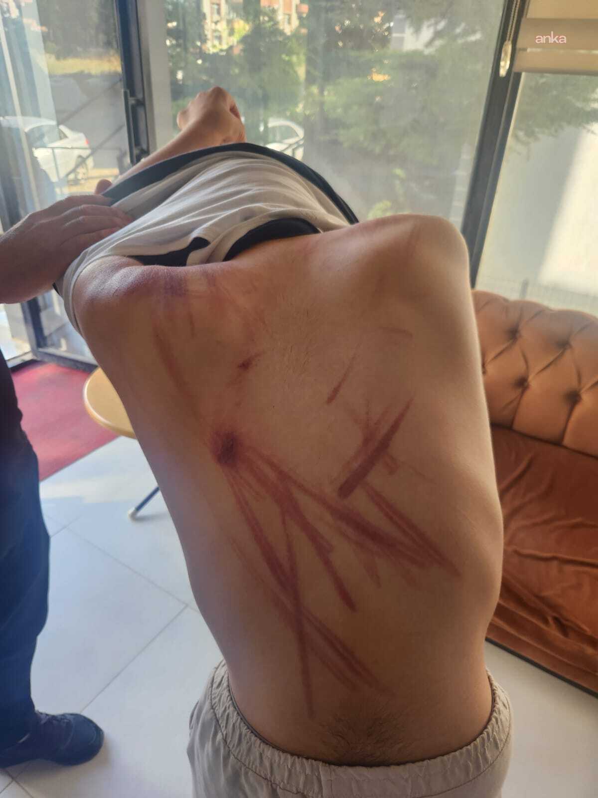 Elazığ’da rehabilitasyon merkezinde down sendromlu çocuğa şiddet iddiası