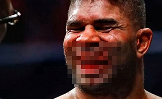 Maç sırasında Alistair Overeem'in dudağı koptu!