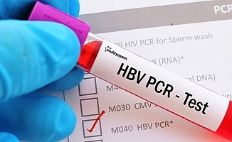 Yurt dışına çıkacak olan vatandaşların yaptırması gereken PCR testi ücreti belli oldu